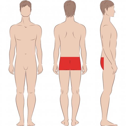 Male Buttocks Including Anal Laser Hair Removal