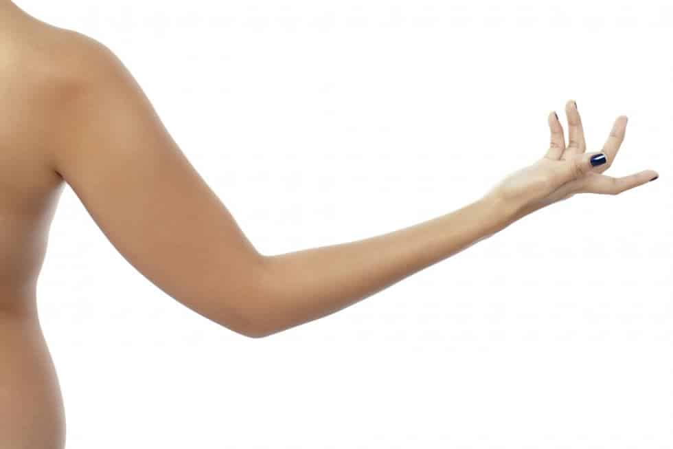 laser hair removal for arms