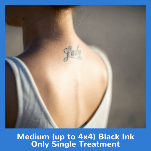 Medium (up to 4x4) Black Ink Only Single Treatment