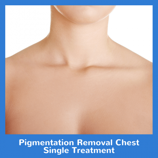 Pigmentation Removal Chest Single Treatment