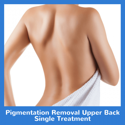 Pigmentation Removal Upper Back Single Treatment