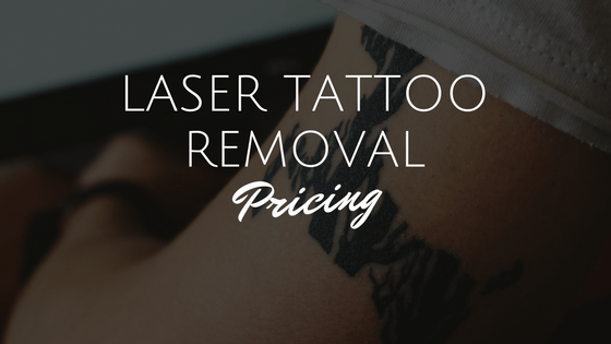 Laser Tattoo Removal Pricing