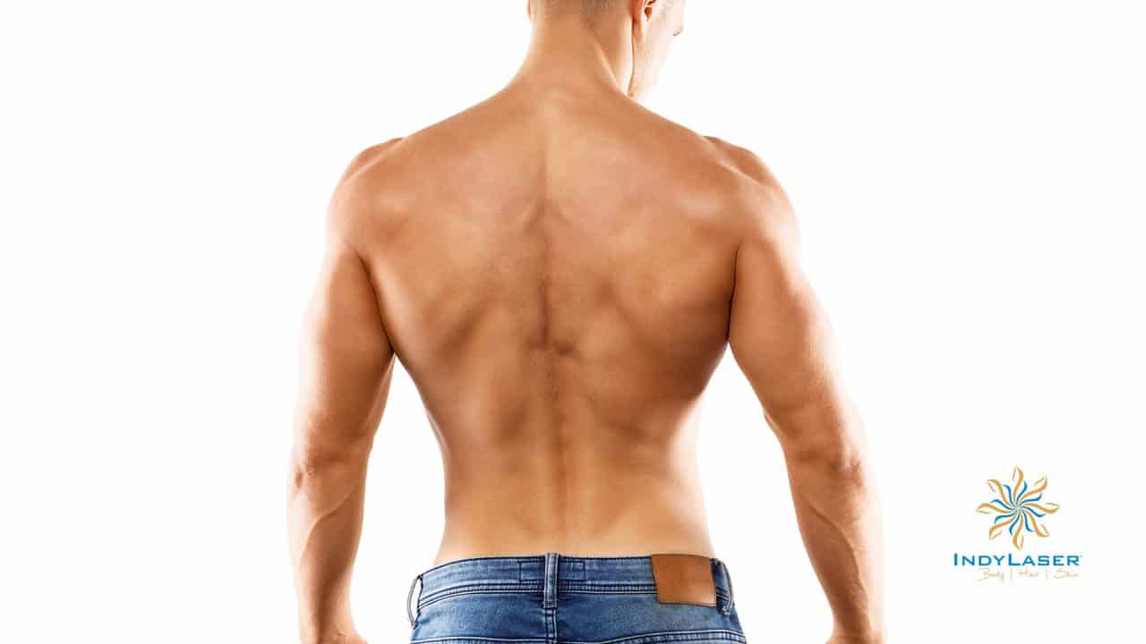 5 Facts Everyone Should Know About Lower Back Hair Indy Laser