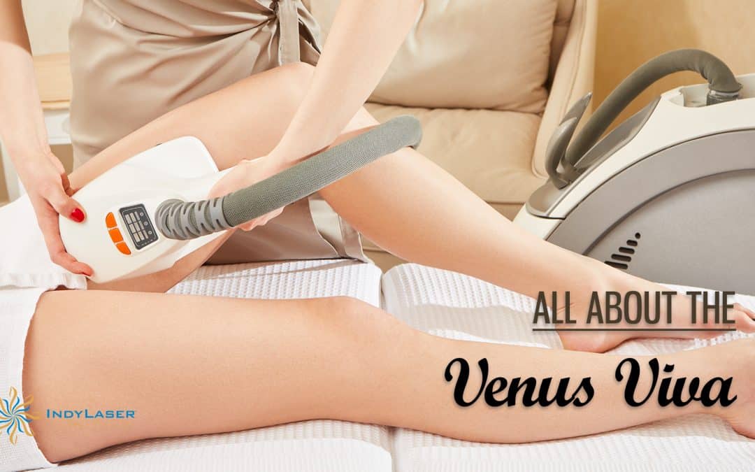 All About The Venus Viva