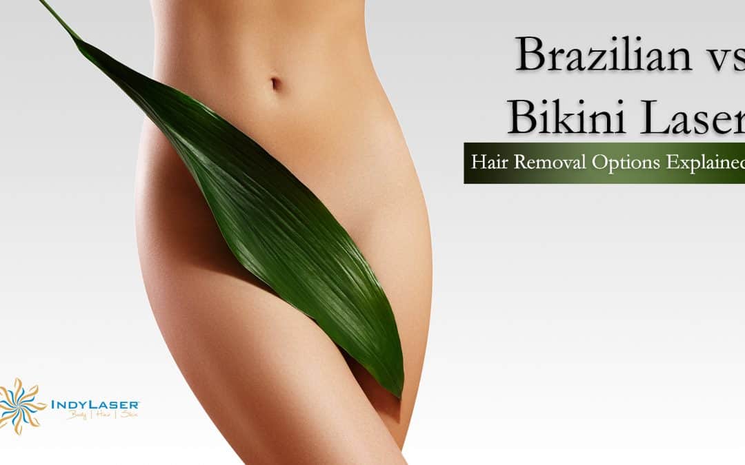 Brazilian vs Bikini Laser Hair Removal Options Explained
