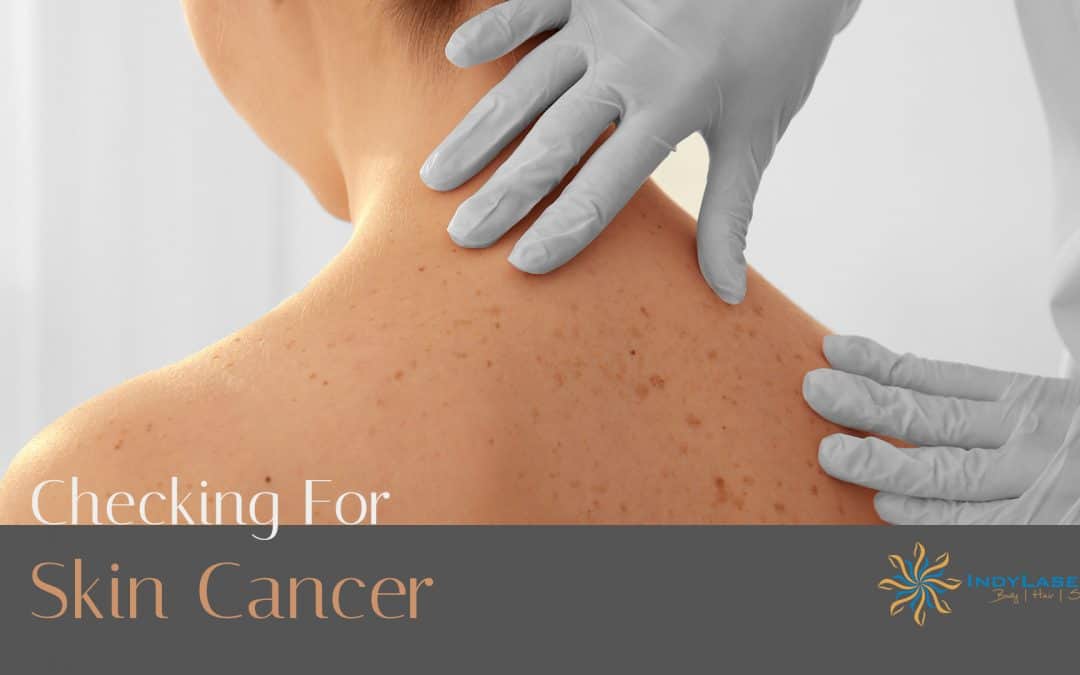 Checking For Skin Cancer