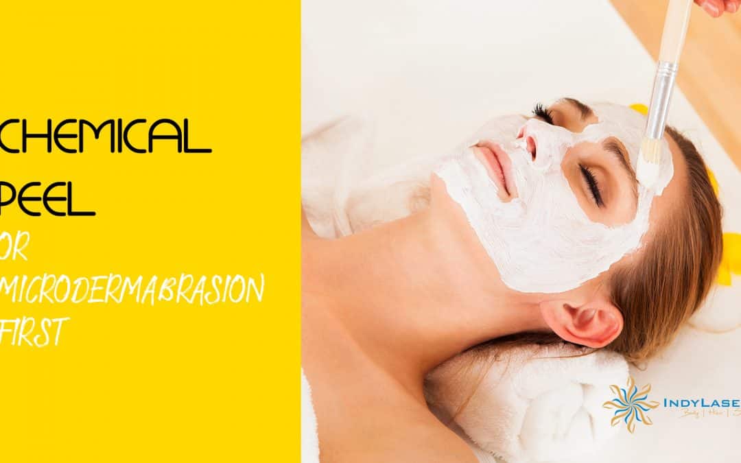Chemical Peel Or Microdermabrasion First