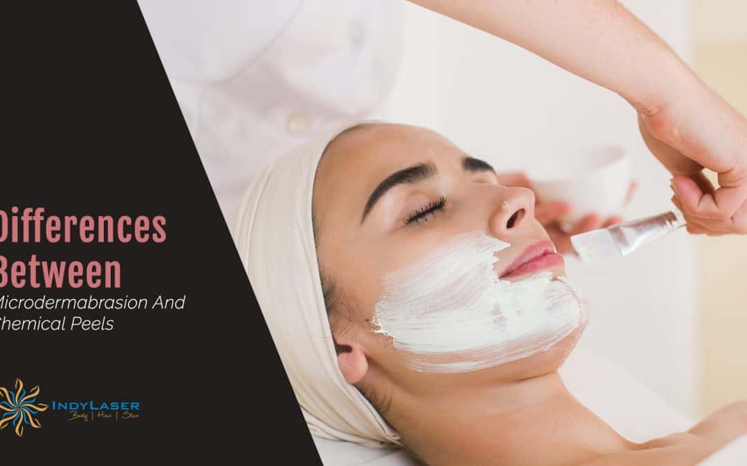 Differences Between Microdermabrasion And Chemical Peels