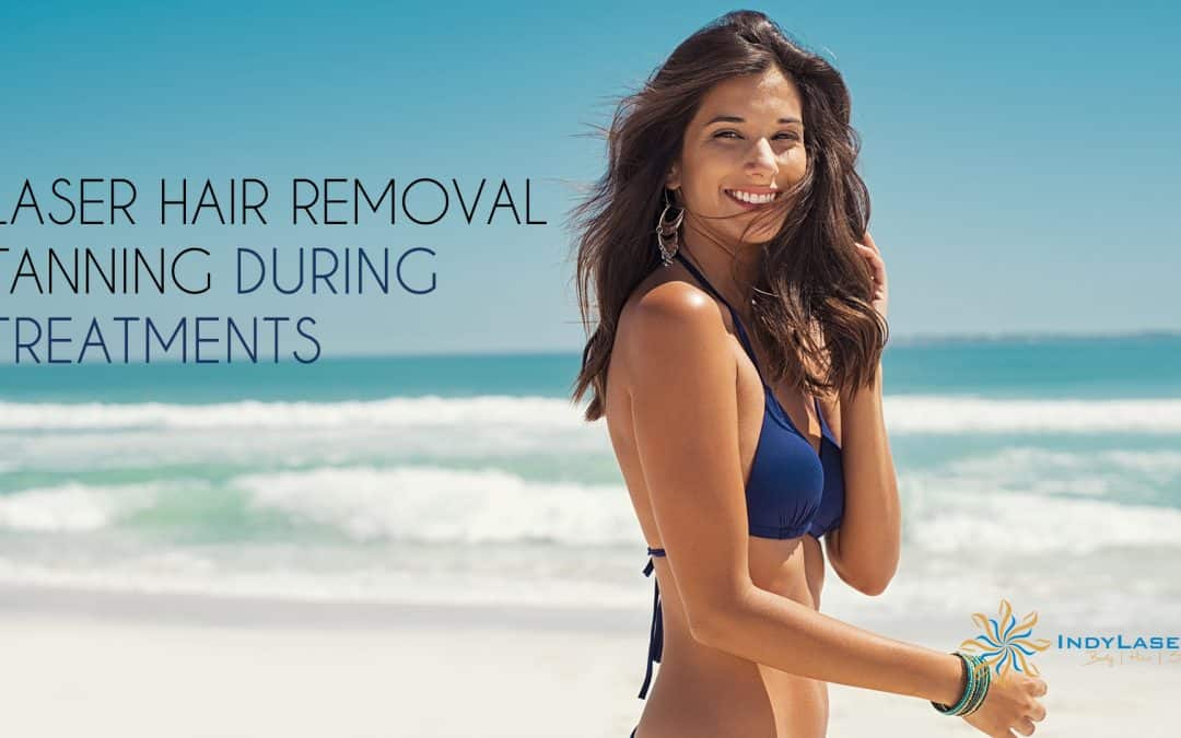 Laser Hair Removal Tanning During Treatments