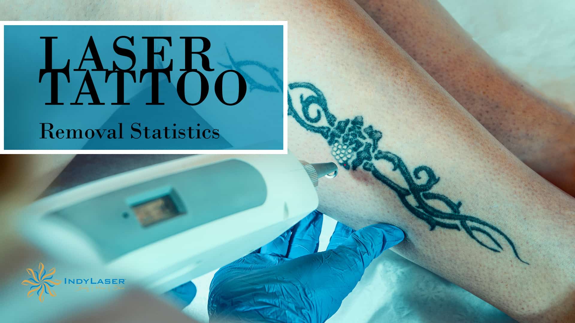 Podcast: How Many People Regret Their Tattoo? | FiveThirtyEight