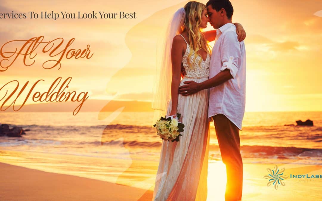 Services To Help You Look Your Best At Your Wedding