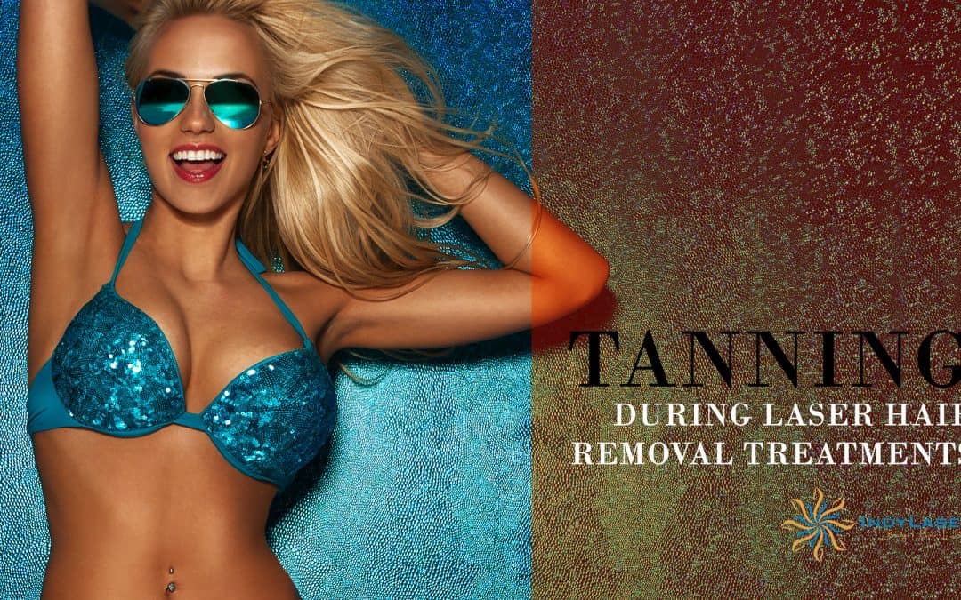 Tanning During Laser Hair Removal Treatments